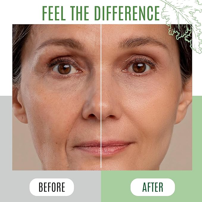 Soothing Skin Care Serum - Kale and Vitamin B Serum - Brightening Serum for All Skin Types - Hydrating Serum with Niacinamide, Hyaluronic Acid - Facial Serum Unclogs Pores, Combats Dryness