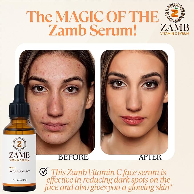 Zamb 15% Vitamin C Face Serum for Glowing Skin – Anti Aging, Hydrating, Brightening, Dark Spot Remover, Even Skin Tone, With Hyaluronic Acid & Natural Extract, For all type of skin – 1 fl oz