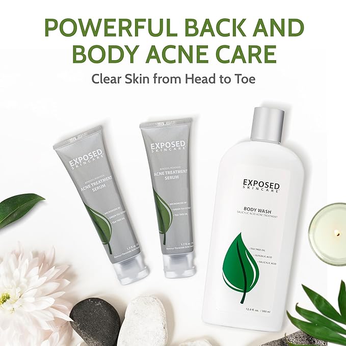 Exposed Skin Care Body Acne Kit – Dual Acne Treatment Serums + Body Wash and Exfoliating Body Cloth – Powerful System Eliminates Pimples and Breakouts to Quickly Clear Back and Body Acne