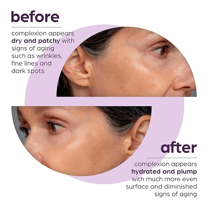 50% Beta Glucan Serum | Mothers Day Gifts for Mom | Anti-Aging, Plumping for Dry Skin, Fine Lines, Wrinkles, Dark Spots | Niacinamide, Centella, Hyaluronic Acid | Korean Skincare | Non-Greasy