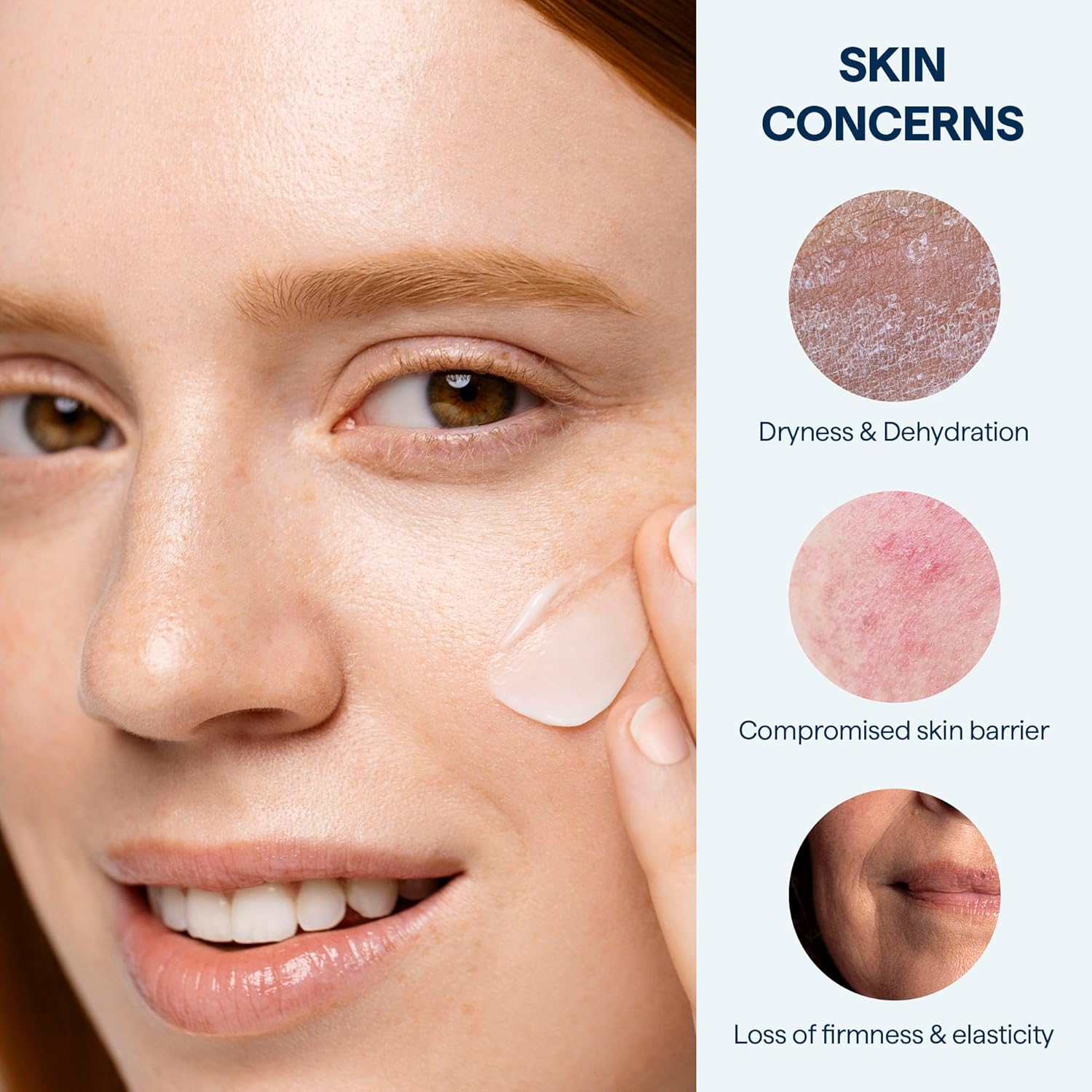 Remedy for Rich Moisture - Barrier Repairing Rich Cream Moisturizer for Normal to Dry Skin - Quadruple Ceramide Complex, Peptides, Squalane, Glycerin- By Dermatologist Dr. Shah, 1.7 fl. oz