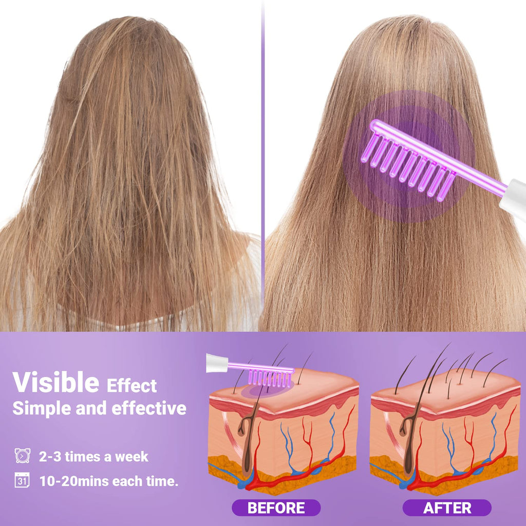 High Frequency Facial Wand-UUPAS Portable Handheld High Frequency Facial Machine Skin Facial Wand with 4 Violet Tubes