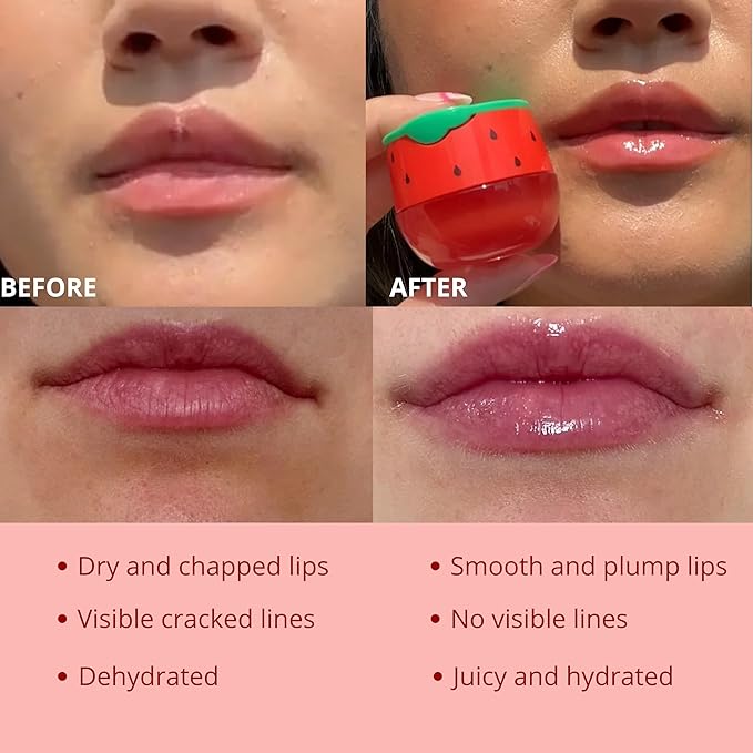 Original My Bee Balm Lip Balm - Watermelon Hydrating Balm Honey Pot for Dry, Chapped & Cracked Lips with Propolis, Honey & Vitamin E - Soften, Smooth & Reduce Lip Lines