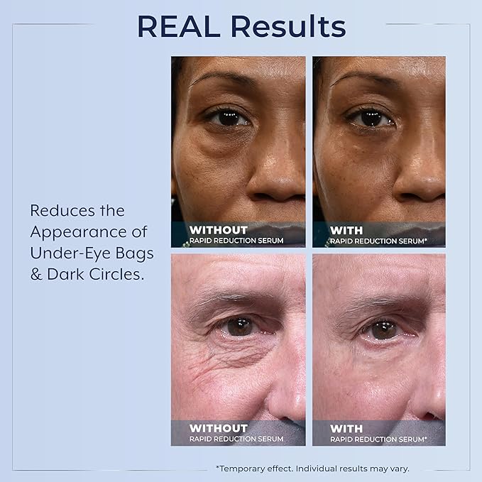 Plexaderm Rapid Reduction Eye Serum - Visibly Reduces Under-Eye Bags, Wrinkles, Dark Circles, Fine Lines & Crow's Feet Instantly, Anti Aging Wrinkle Remover for Face, 30 Single Use Pods
