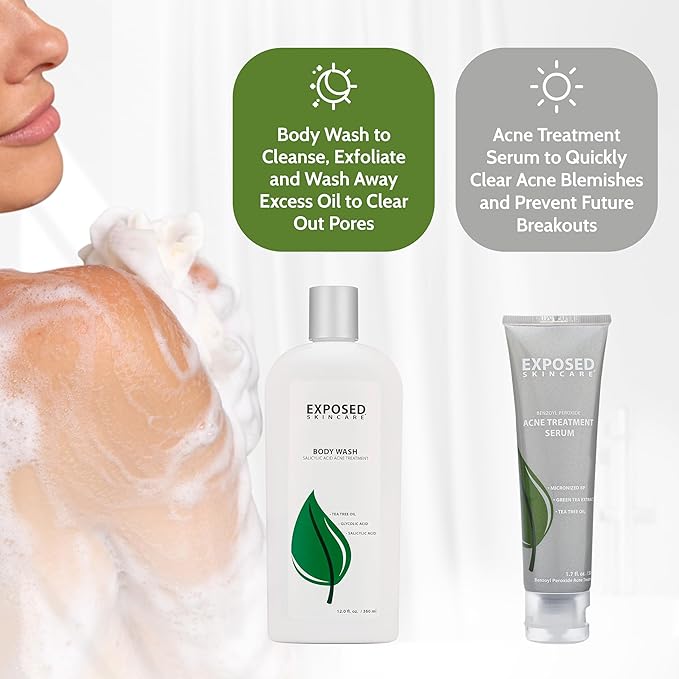 Exposed Skin Care Body Acne Kit – Dual Acne Treatment Serums + Body Wash and Exfoliating Body Cloth – Powerful System Eliminates Pimples and Breakouts to Quickly Clear Back and Body Acne