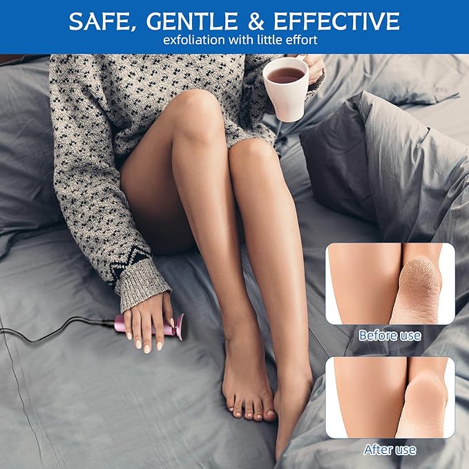 Dermave Electric Foot Callus Remover, Electric Foot Callus Remover, Callus Remover for Feet - Foot Filer with 60pcs Sanding Discs for Dead Cracked Skin, Men/Women (Pink)