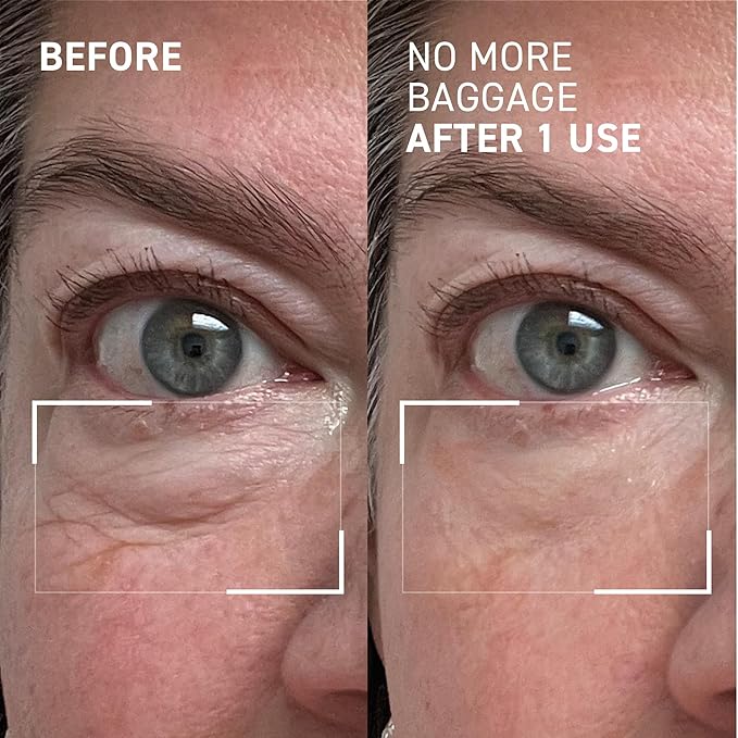 Dr. Brandt Needles No More, No More Baggage - 0.5 oz, Pack of 2 - Minimizes Under-Eye Bags, Puffiness & Dark Circles