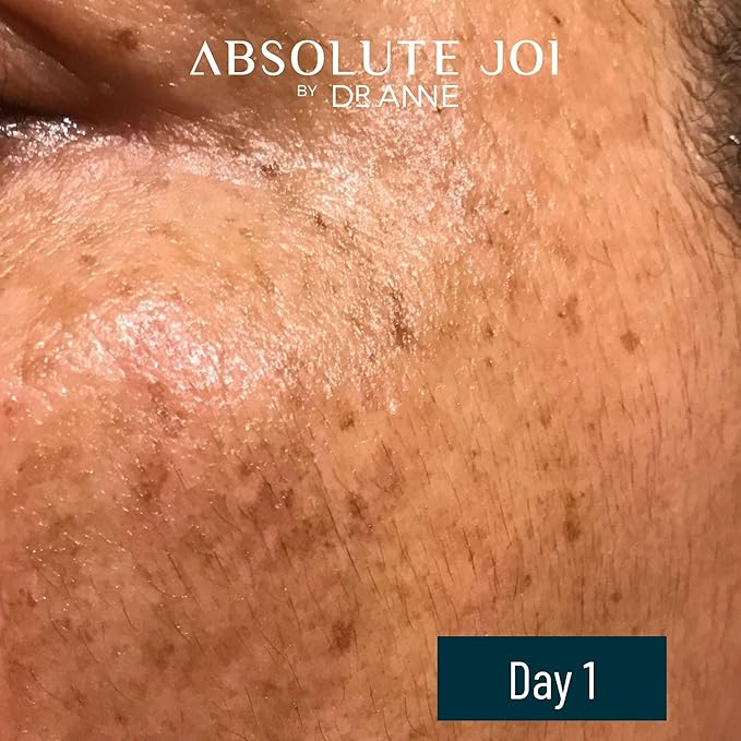 Retinol Oil Serum with Vitamin C, Skin Refining Night Oil for Fine Lines and Hyperpigmentation with Sensitive Skin Friendly Granactive Retinoid - Unscented - 0.5 Fl Oz Sample Size