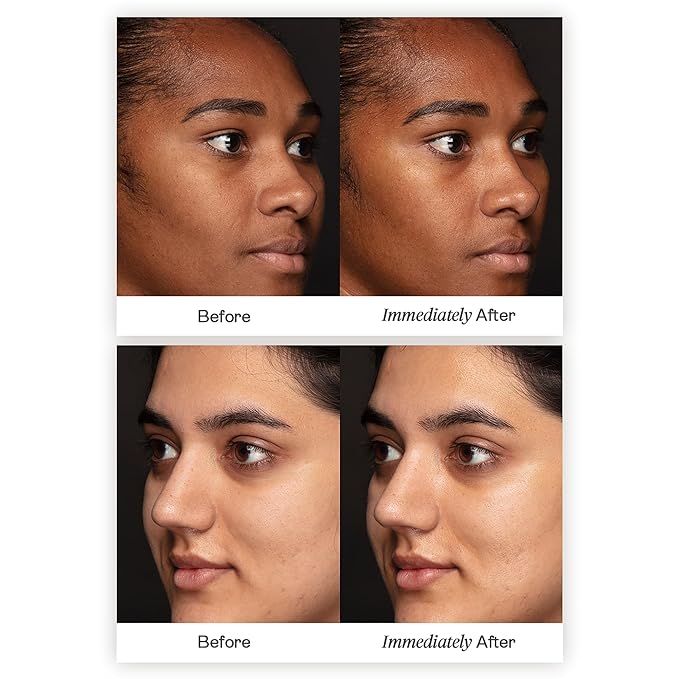 BeautyStat Triple-Plump Coconut Milk Serum - Moisturize, Plump, & Revitalize with Hyaluronic Acid, Polyglutamic Acid, Microsilver, & Coconut Complex (30 ml / 1 fl oz)