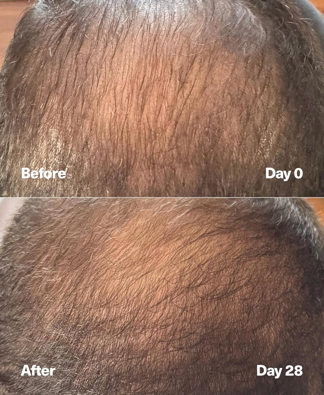 PowerCycle Exosome Hair Growth Serum - Clinically Advanced Scalp Treatment for Thinning Hair, Hair Loss Prevention & Regrowth - Lightweight Formula for Women & Men, Without Minoxidil, 60mL