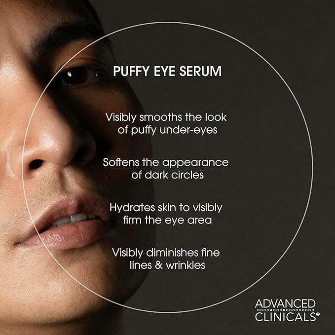 Advanced Clinicals Puffy Eye Under Eye Serum | Visible Anti Aging Brightening Vitamin C + Caffeine Serum Helps Improve Look Of Puffiness, Fine Lines, Dark Circles, & Uneven Skin Tone, 1.75 Fl Oz