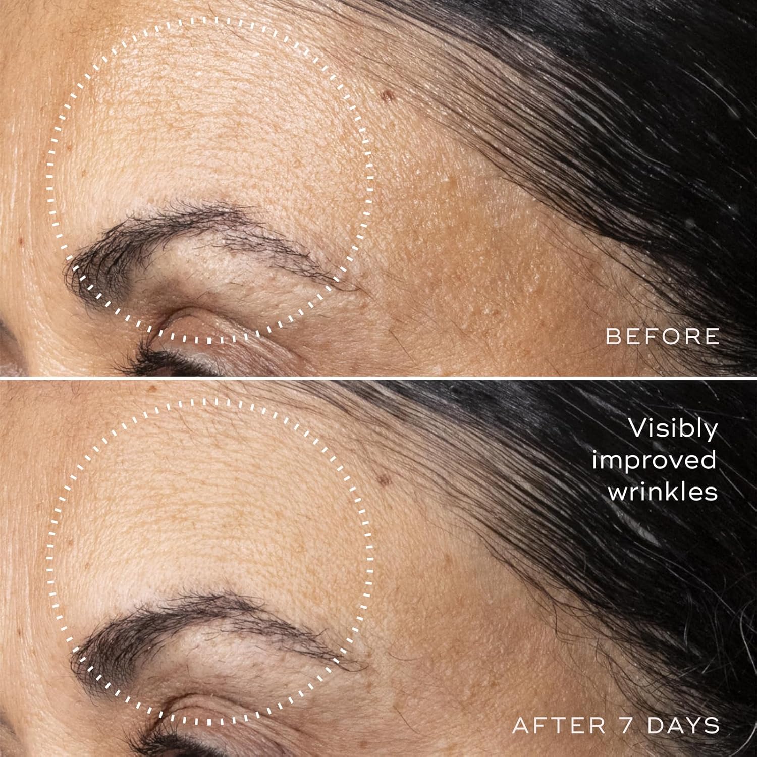 Medik8 C-Tetra Advanced - Balancing, Plumping, Hydrating Daily Vitamin C Serum with Hyaluronic Acid, Squalene - Smooths Fine Lines, Wrinkles - 1.0 oz