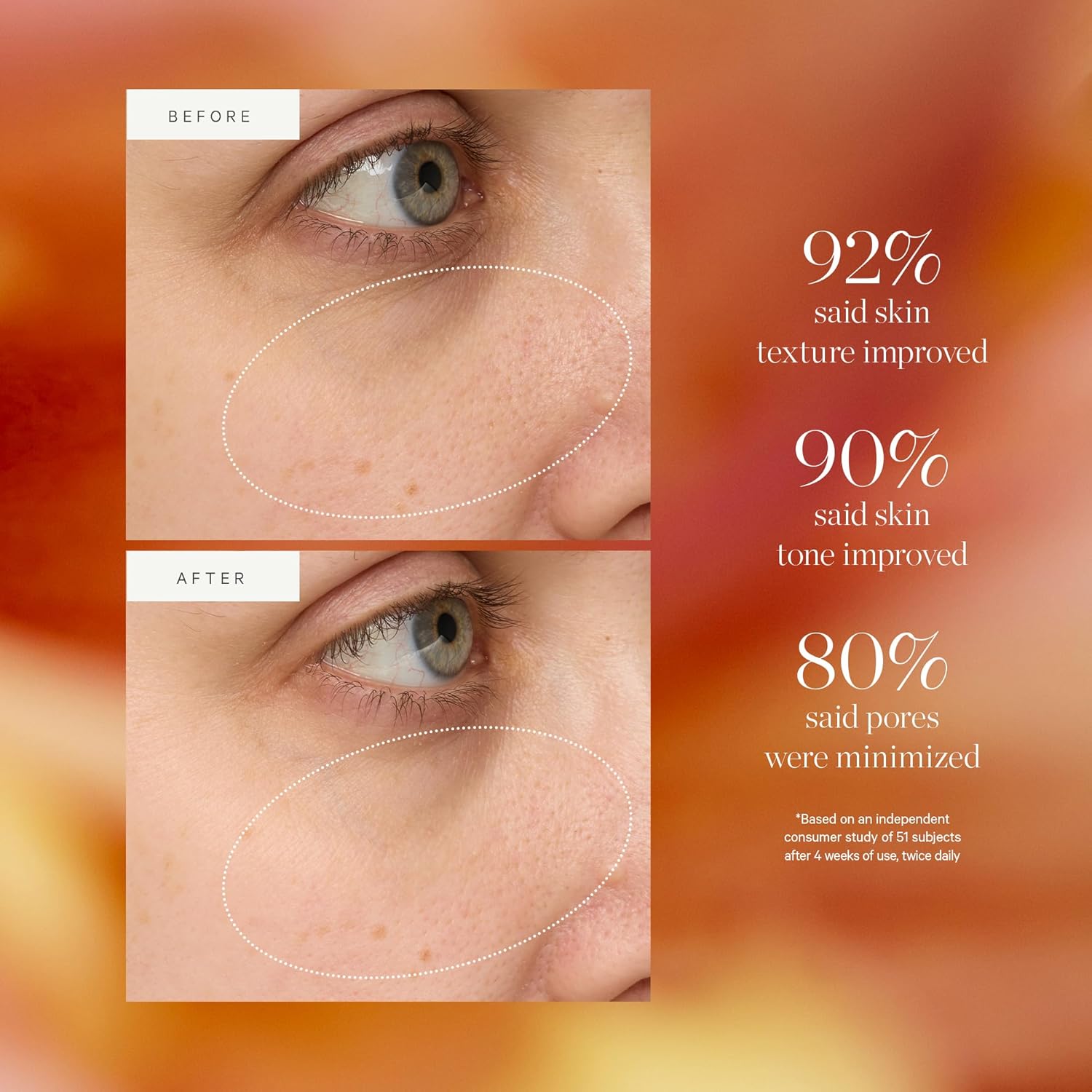 KORA Organics Turmeric Glow Drops, Niacinamide Alternative Face Serum for Radiance, Texture and Pore Appearance, Certified Organic, Vegan, 0.34 fl oz