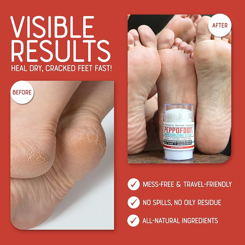 Rinse Bath & Body Peppofoot Heel Balm Stick - Handmade Heel Balm for Dry Cracked Feet with Peppermint and Tea Tree Oils | Ultra Moisturizing | No Mess Cracked Heel Stick | All Natural | 2oz