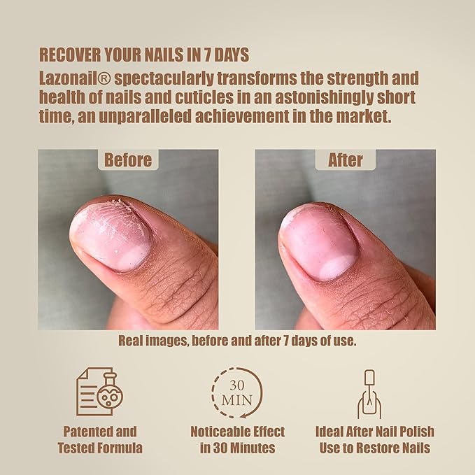 Nail Strengthening & Repair Gel, Restores Brittle Nails from Damage Caused by Manicures & Harsh Environments, Infused with 94% Walnut Extract, Honey Colored