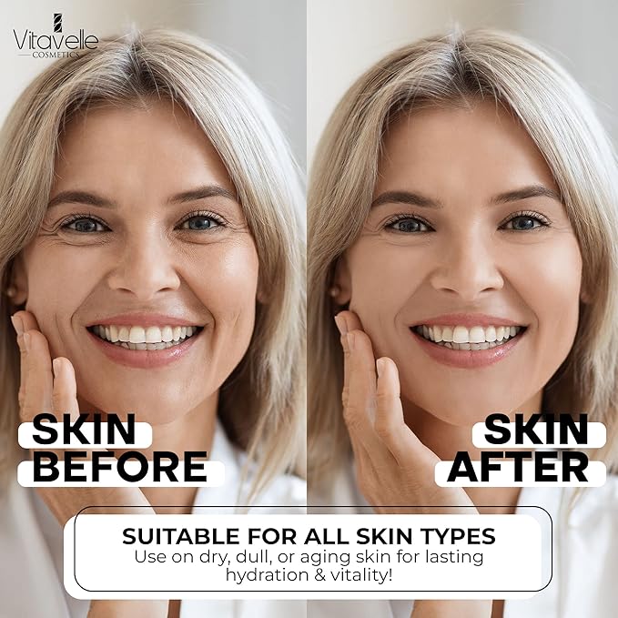 Hyaluronic Acid Serum with Aloe Vera – Anti Aging Aloe Hyaluronic Acid Face Serum – Postbiotic Hyaluronic Acid Moisturizer and Hydrating Serum – No Parabens or Irritants – Skin Serum by Vitavelle