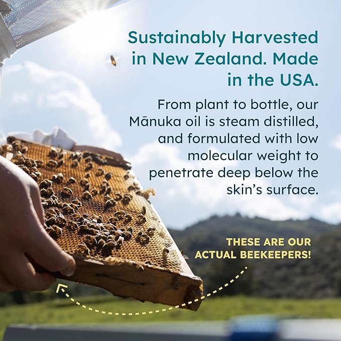 Manuka Honey Body Lotion (7oz), Moisturizing Lotion with Soothing Manuka Honey & Oil for Dry, Very Dry, Sensitive, or Aging Skin – Cream Moisturizer for Women & Men