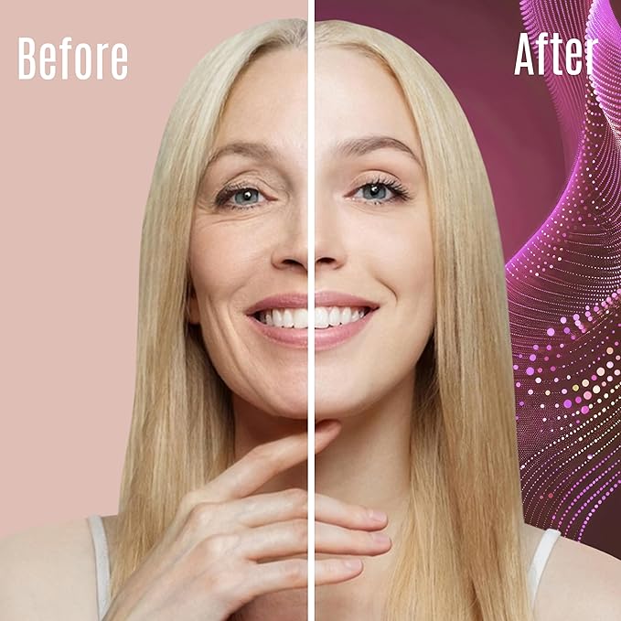 Retinol Cream – 3% (Percent) Retinol Cream for Face with Hyaluronic Acid – Anti-Aging Face Cream for Fine Lines and Wrinkles – Hydrating Face Moisturizer with Shea Butter, Aloe Vera