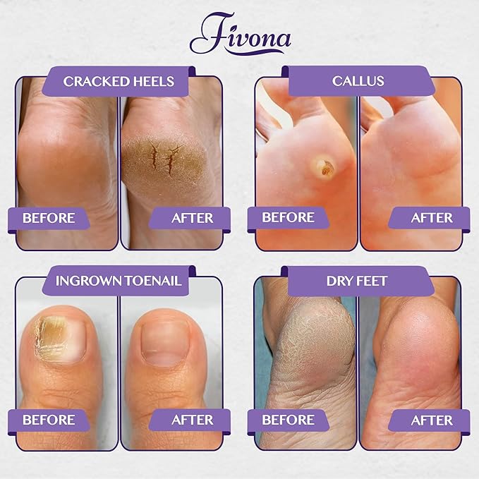 Fivona Foot Soak Blend Epsom Salt with Lavender 14.1 oz - Calming Foot Bath Salt, Relax & Renew Tired Feet, Soothe Soreness, Soften Calluses - Rejuvenating Pedicure Spa at Home