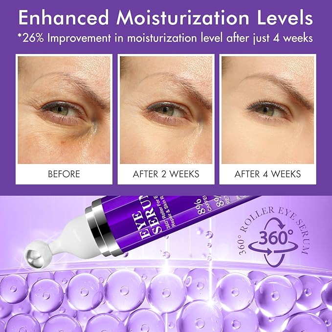 Under Eye Roller Serum|5% Caffeine 5% Retinol Eye Cream for Dark Circles, Puffiness and Bags, Puffy Bags Fine Lines Wrinkles, 360° Massage Ball Cream, 8% Hyaluronic Acid Serum