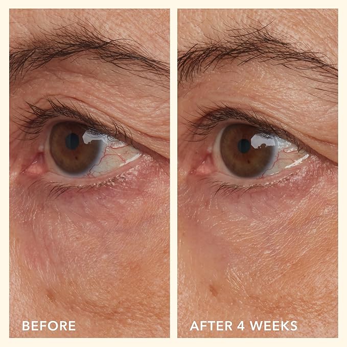 Beekman 1802 Mushroom Goat Milk Eye Cream - Clinically Proven Anti-Aging Eye Treatment for Dark Circles & Fine Lines - With Kojic Acid, Hexapeptide & Mushrooms - Fragrance-Free, Cruelty-Free