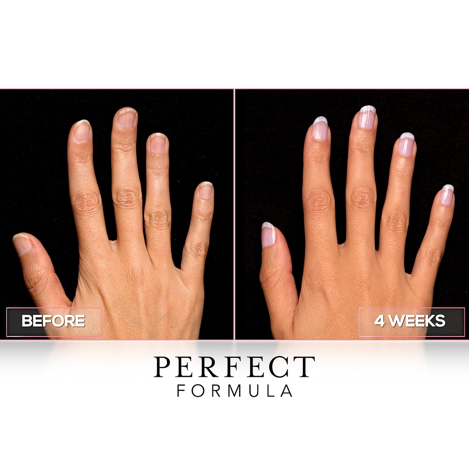 Perfect Formula Clear Gel Coat - Nail Strengthener, Keratin Treatment, Clear Nail Polish - Strengthener for Damaged Nails - Made In The USA .60 fl oz.