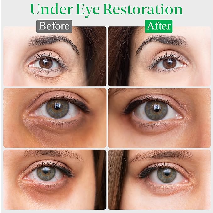 EyeGLO Caffeine Eye Cream for Dark Circles, Eye Bags, and Puffiness | UnderEye Treatment for Women with Peptides, Antioxidants, Hyaluronic Acid | Natural Brightening EyeCream - 1 Oz