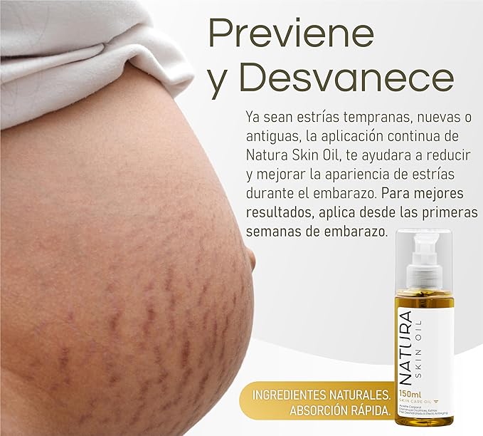 Natura Skin Oil 5fl OZ - Anti-Stretch Marks and Scars Body Oil Skin Care Firming, Non-Greasy, Deeply Hydrates and Nourishes - Tensor and Skin Repair Effect., Gold