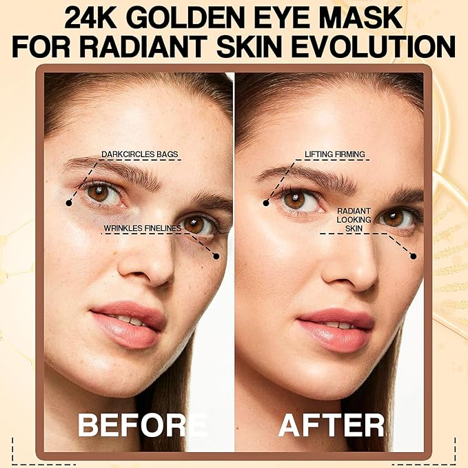 Under Eye Patches for Women (30 Pairs) - Eye Patches for Puffy Eyes and Dark Circles - Skin Care with Collagen eye patches for women - Anti-Aging Eye Masks (24 Gold- Box)