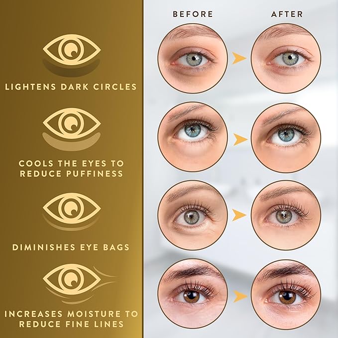 Under Eye Patches (72 Patches) for Puffy Eyes and Dark Circles with Pure Collagen, 24K Gold Eye Gel Pad Masks for Reducing Eye Bags, Puffy Dark Circles, Wrinkles, and Fine Lines
