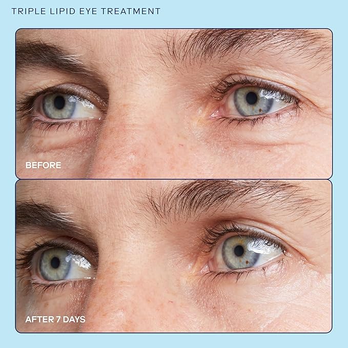 Skinfix Barrier+ Triple Lipid Eye Treatment: Infused with Caffeine, Niacinamide, and Peptides for Depuffing, Tightening, and Under-Eye Brightening, 15 ml