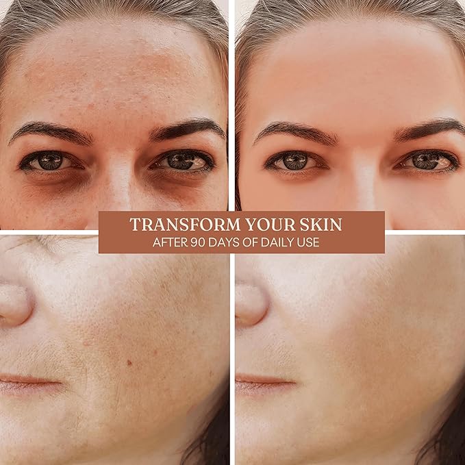 Organic Rosa de Mosqueta Oil- USDA Certified Rosehip Seed Oil Pure Cold Pressed, Repairs & Brightens Skin - Gua Sha Massage, Face, for All Skin Types - Aceite Facial 1OZ