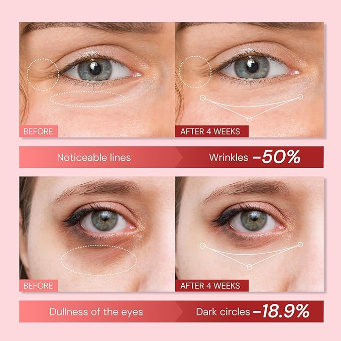 Anti Aging Eye Cream for Wrinkles: Retinol & Polypeptide Under Eye Treatment - Reduce Dark Circles, Puffiness, Crows feet - Repair Women's Eyes Contour, 0.85 fl. oz