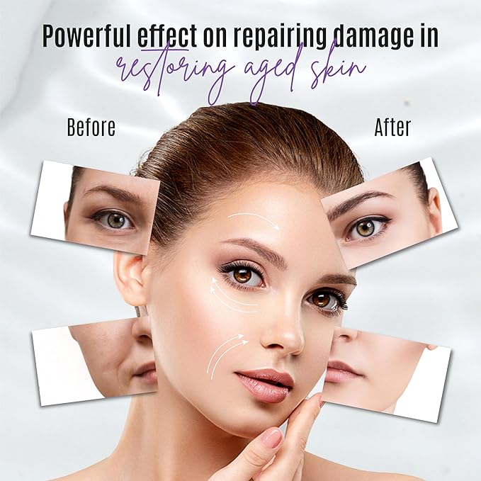 30% Matrixyl 3000 Lift And Firm Elasticity Repair Formula- Pure Organic Powerful Triple Combination Cream/reduce Sun Spots (Peptide Booster Cream)