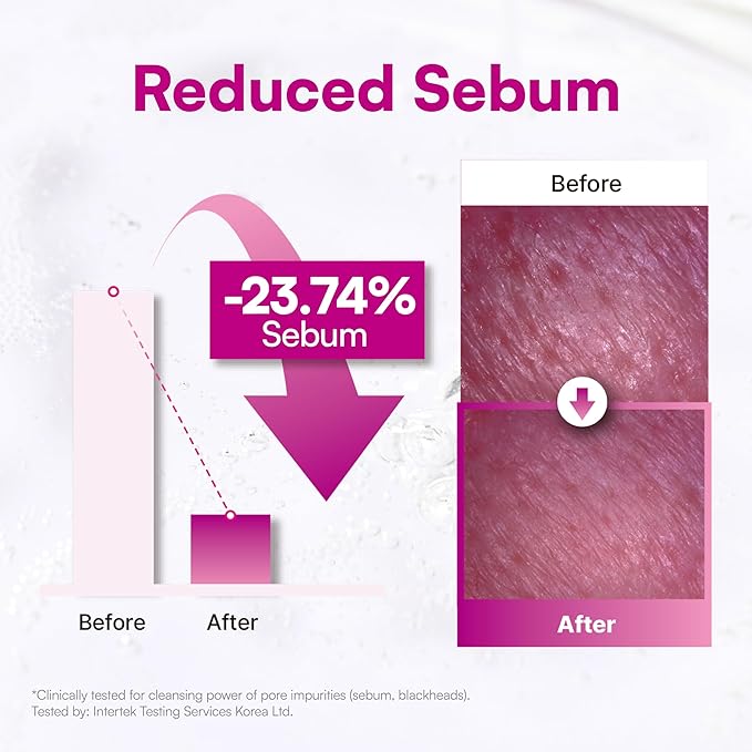 Face Republic Blooming Rose Melt & Remove Pore Cleansing Oil 150ml 5.07 fl oz | Oil Cleanser for Face | Pore and sebum care, Blackhead remover | Waterproof Makeup remover | Vegan Korean Skin Care