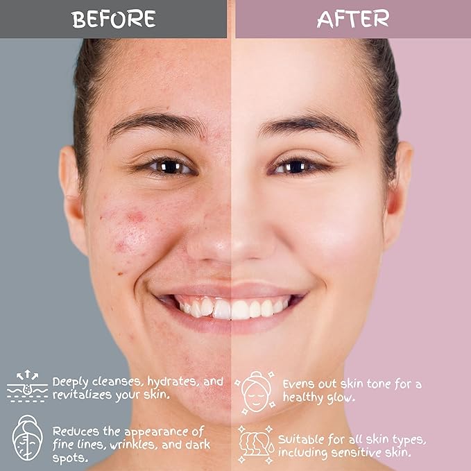 Luxurious Korean Style Cherry Blossom Facial Cleanser & Moisturizer Set, Facial Cleanser, Moisturizer, Revitalizer, Serum, Rejuvenator, Eye Cream, Daily Skincare Routine, Retinol Free