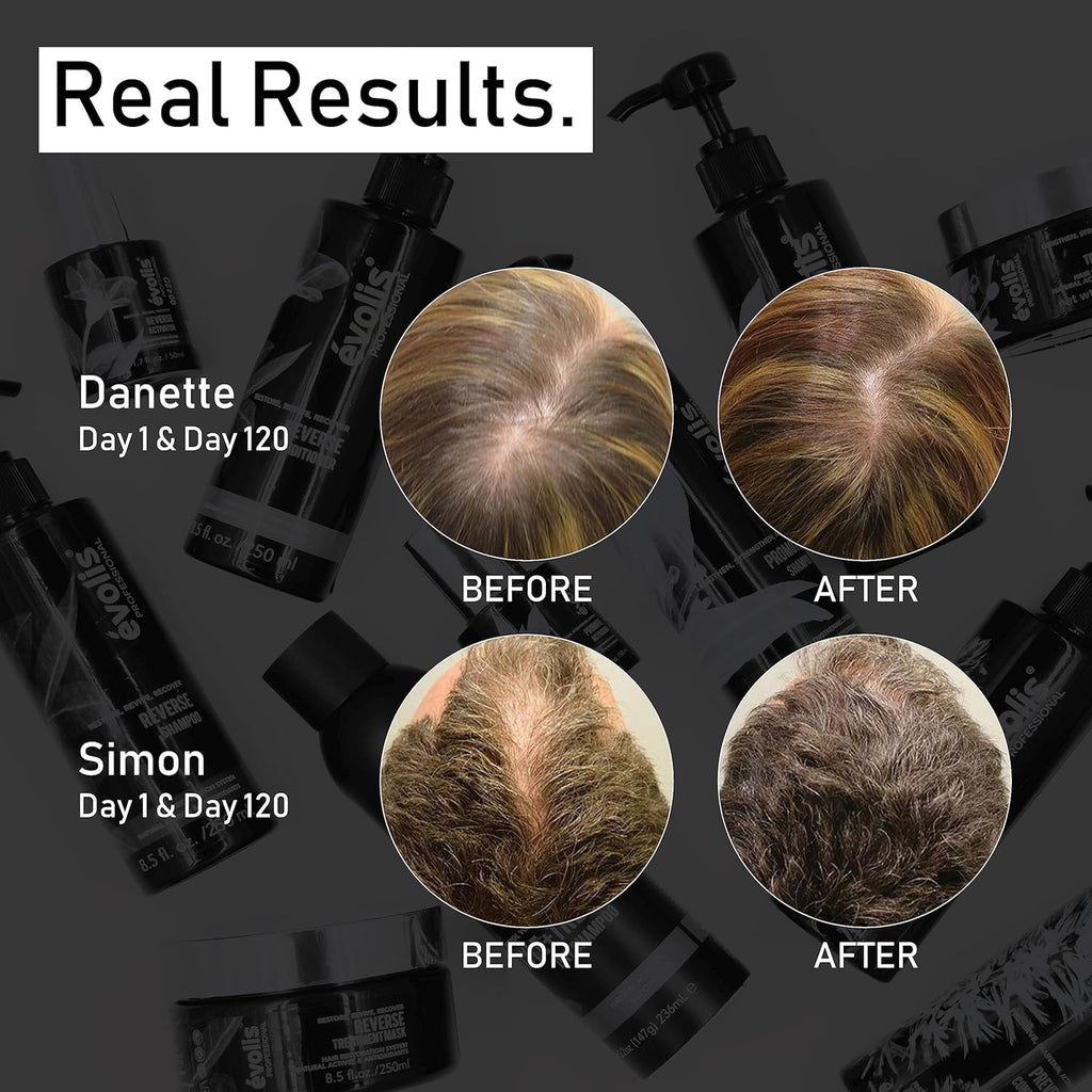 EVOLIS Promote Scalp Activator - Scalp Serum for Longer, Stronger Hair – Hair Repair Treatment – Hydrating Hair Growth Serum with Baobab & FGF5 Blockers (1.7 fl oz)