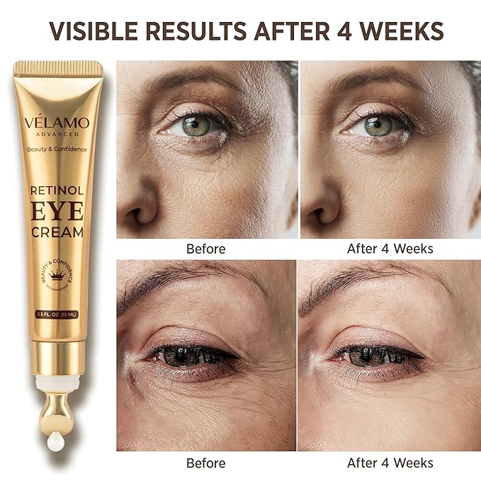 Instant Eye & Face Lift Cream: Rapid Under Eye Bags Wrinkle Smile Lines Forehead Lines Remover - Temporary Firming & Tightening Treatment in 2 Minutes - Retinol Eye Cream Anti Aging Anti Wrinkles 15g