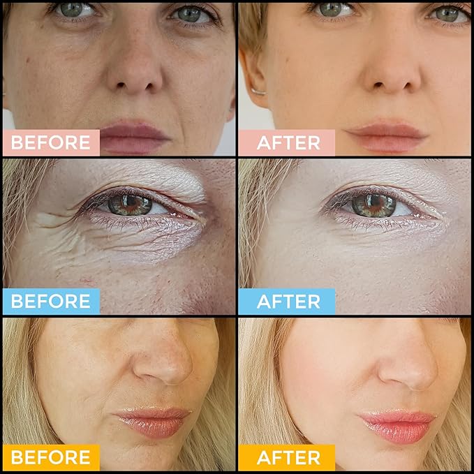 Face Serum Set – Retinol Serum, Vitamin C Face Serum & Hyaluronic Acid Serum for Face – Anti Aging Serum Skin Care Set for Women – Serum for Firm, Wrinkle Smoothing 3x1oz