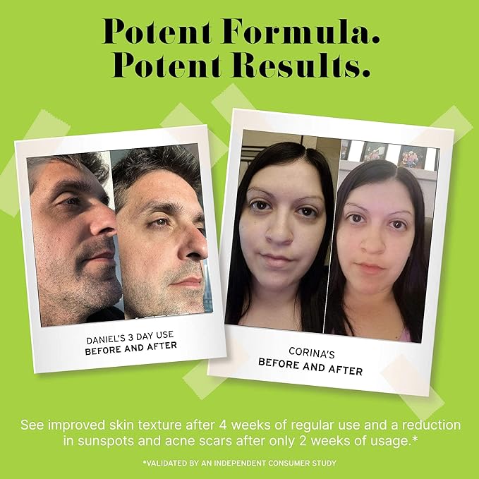 No B.S. (No Bad Stuff) Caffeine Eye Cream anti aging bundle with Two CoQ10 Deluxe Minis. Under Eye Cream for Dark Circles and Puffiness. Includes CoQ10 for Wrinkles.