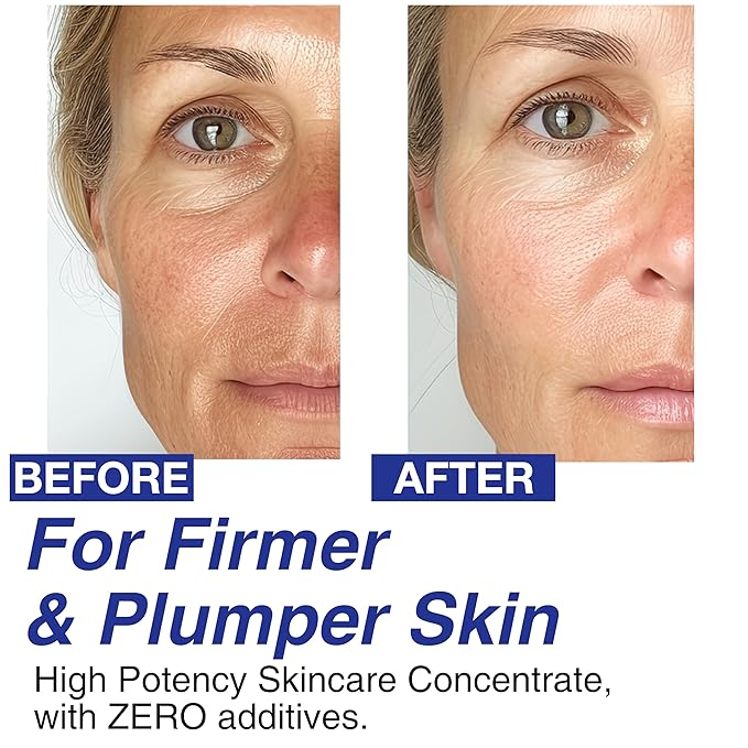 Volufiline & Niacinamide Serum Bundle – 100% Pure Volufiline for Skin Firming + 20% Niacinamide for Pore Minimizing & Brightening – Anti-Wrinkle, Collagen Boosting & Even Skin Tone Korean Skincare