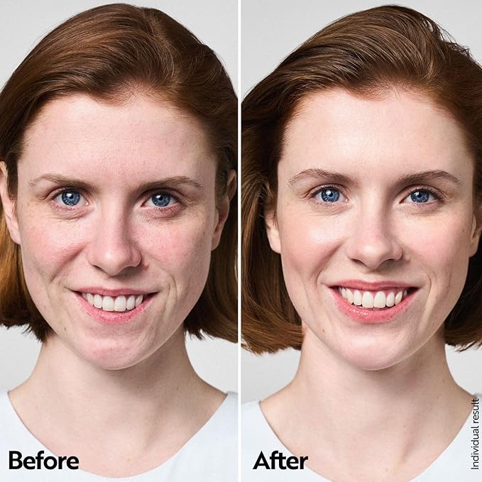 M. Asam AQUA INTENSE Eye Cream (1.01 Fl Oz) – Skin Care with Hyaluronic Acid, Under Eye Cream for Dark Circles, Puffiness & Bags, Hydrating Face Moisturizer for Wrinkles