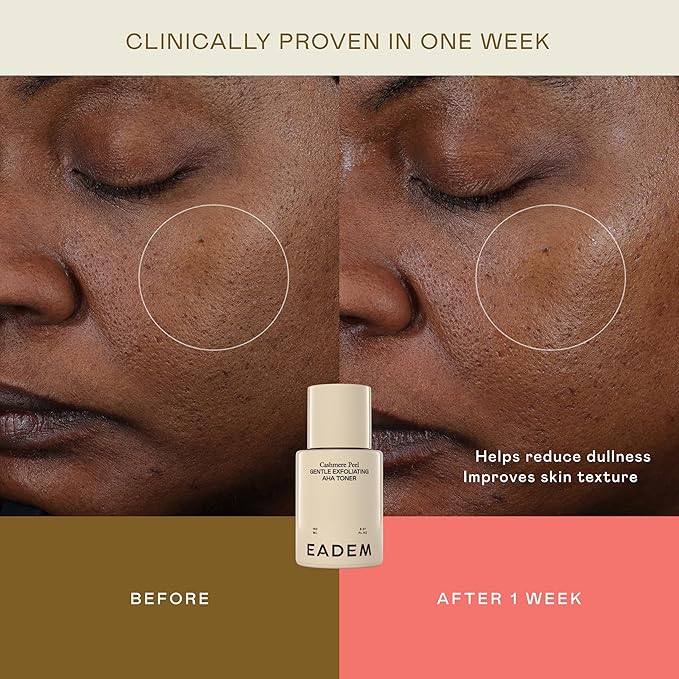 EADEM Gentle Exfoliating AHA & PHA Toner, Exfoliating Face Serum with Tranexamic Acid, AHA Exfoliant & Pore Minimizer for Face and Body, Acne Spot Serum, Mothers Day Gifts, 5.0 oz, Cashmere Peel