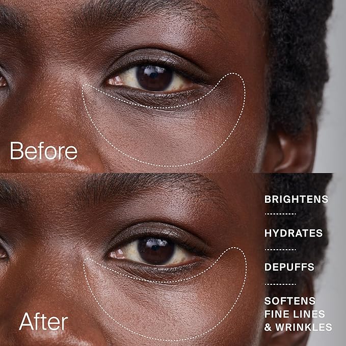 Timeline The Eye Cream - Anti-Aging Cream for Wrinkles, Dark Circles & Under Eye Bags with Urolithin A & Niacinamide (15 ml)