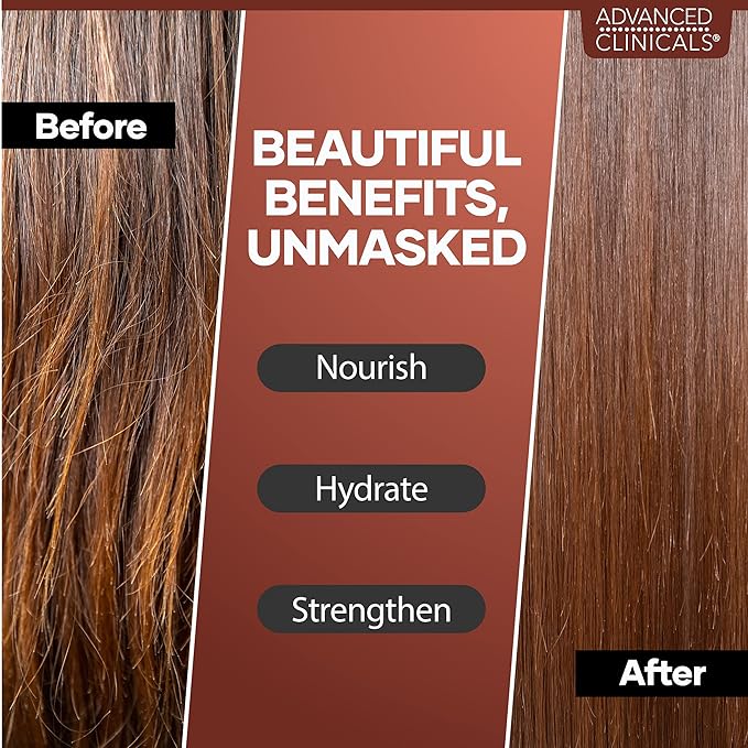 Advanced Clinicals Castor Oil Conditioning Hair Mask Natural Detangler & Hair Treatment W/Jamaican Black Castor Oil, Coconut Oil, & Biotin Repair For Color Treated, Dry, Or Damaged Hair, 12 Fl Oz