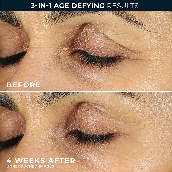 RoC Retinol Correxion Eye Cream Mini for Dark Circles & Puffiness, Daily Wrinkle Cream, Anti Aging Line Smoothing Skin Care Treatment, .25 Ounces