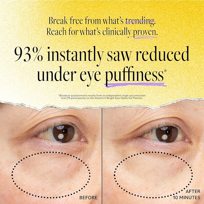 Derma E Vitamin C Bright Eyes Hydro Gel Under Eye Patches (5 Pairs), Allantoin, Caffeine & Vitamin B3, Eye Masks to Helps Reduce Fine Lines, Wrinkles, Dark Circles & Puffy Eyes,10 Ct