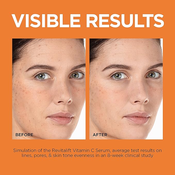 L'Oreal Paris Revitalift 12% Pure Vitamin C Serum, Vitamin E, Salicylic Acid, Brightening 1 oz + Moisturizer Sample